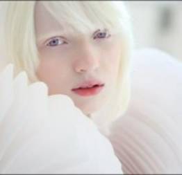 Nastya Zhidkova, a menina albina mais linda do mundo