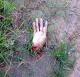 Mão cortada de cadáver dentro do IML é encontrada em quintal de casa