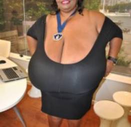 Norma Stitz, a mulher dos maiores seios do mundo