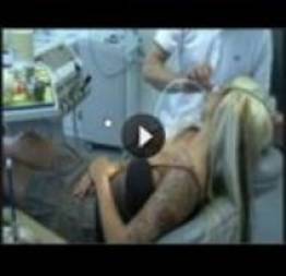 Dentista abusa e fode mulher inconsciente apos aplicar muita anestesia (vídeo)
