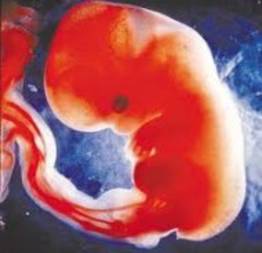 Maioria da população é contra o aborto, diz pesquisa